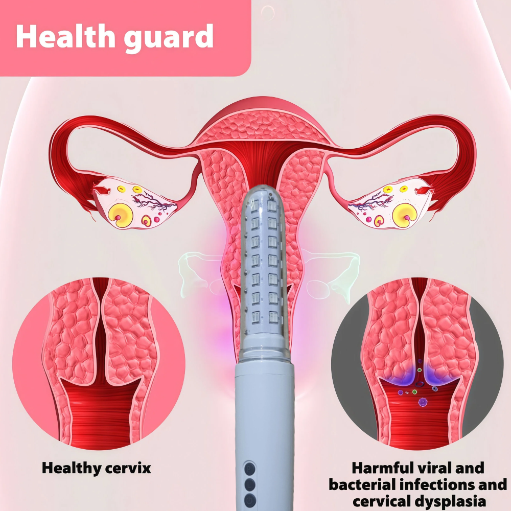 650nm LLLT Cold Laser Wand for - đánh giá và giá Therapy Health And Wellness